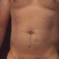 Roanoke_Nudist