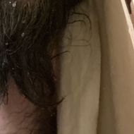 Ckin31