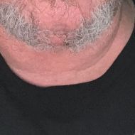 Rob911