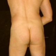 2Nudes