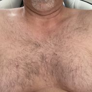 TnNudist